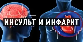 Инфаркты и инсульты в России стали встречаться на 5-10 лет раньше