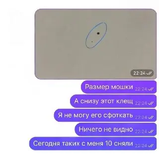 Микроклещи в России: угроза для здоровья и распространение заболеваний