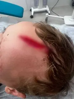 Собака напала на внука Дарьи Донцовой в Подмосковье