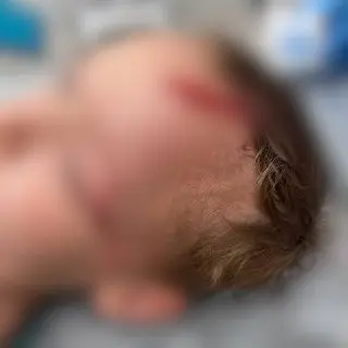 Нападение собаки на ребенка: возбуждено уголовное дело