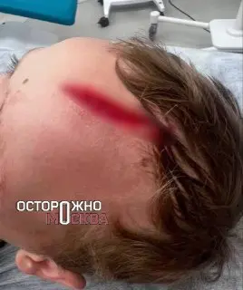 В Одинцово собака напала на мальчика: подробности инцидента