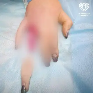 Женщина из Москвы чуть не лишилась пальца из-за кольца