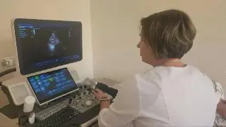 Новые УЗИ-аппараты в Люберцах: 6,5 тыс. исследований за три месяца